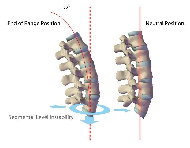 Functional View — Range-of-motion test