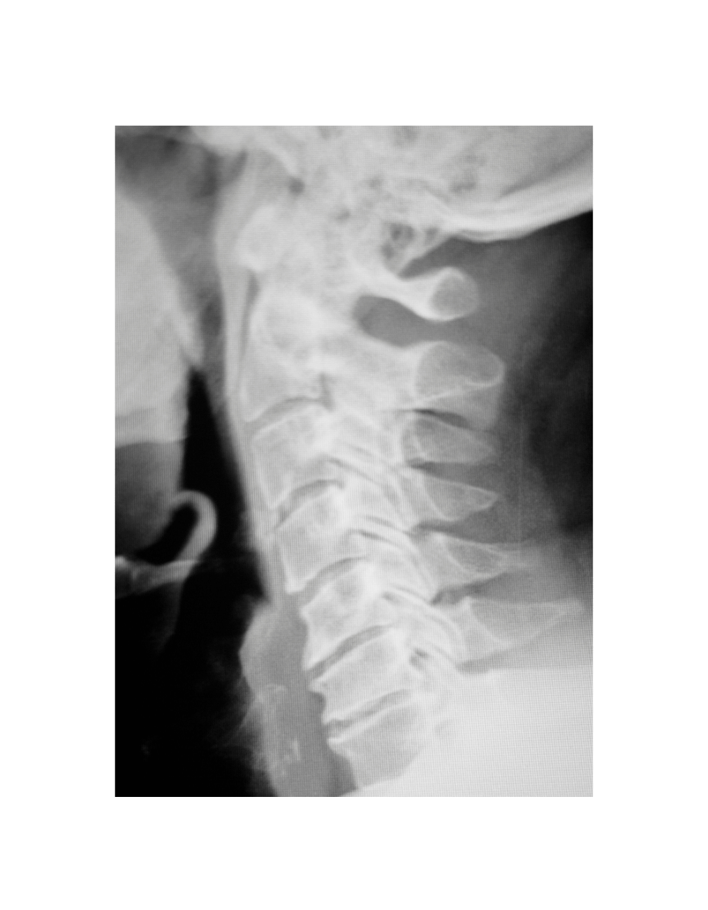 Full Spine — Structural diagnostic